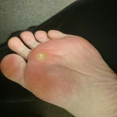 痛みは放っておいたらだめですよ