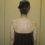 ☆感動☆ＬＡＧＥ施術体験！！