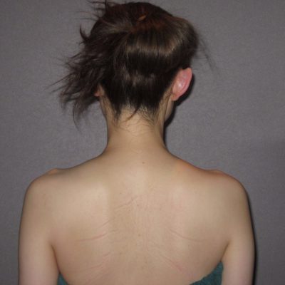 ボディーライン