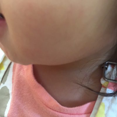 Ｂａｂｙスキン♪