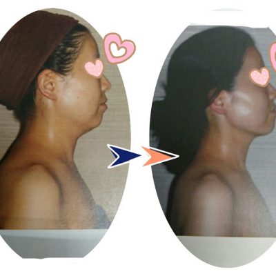 1年後、感動の変化！