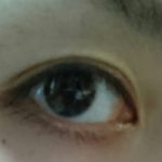 目の老化を防ぐ