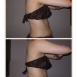 下半身調整の効果