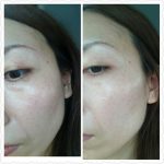 クリームの大切さ