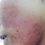 お肌きれいになったよね！