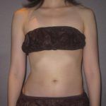 こんなに歪みが変わりました