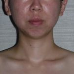 3年前の私より今の方が若い！