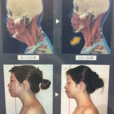 横すがた(姿勢)