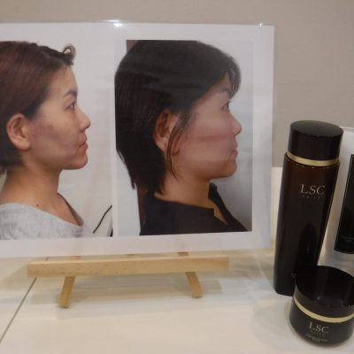 ターンオーバー☆