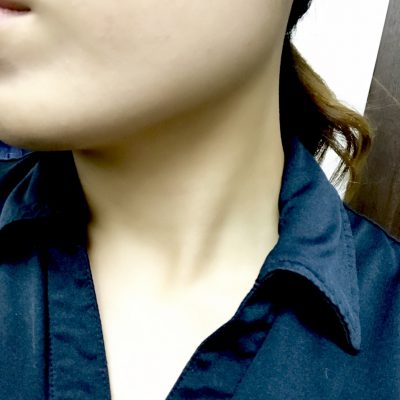 綺麗なフェイスラインに・・・