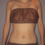 ウエストヒップ　骨盤矯正