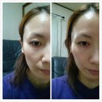 スキンケアでたるみ解消