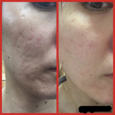 『衝撃的すぎて、公開』