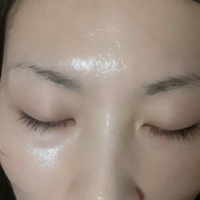 ハーブピーリング