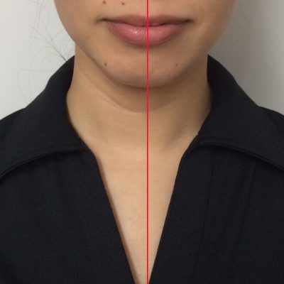 首の印象は大きい!