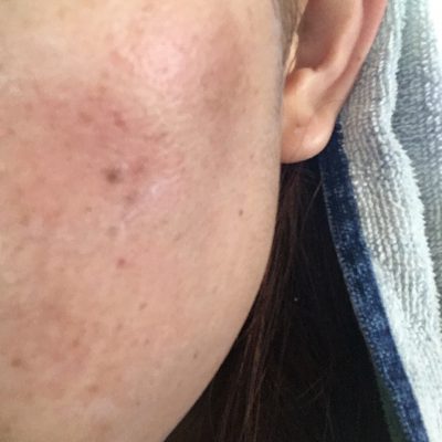 甲府店makoの美肌への道～修行①～