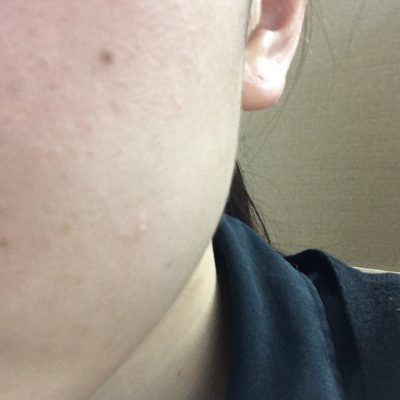 甲府店makoの美肌への道～修行②～