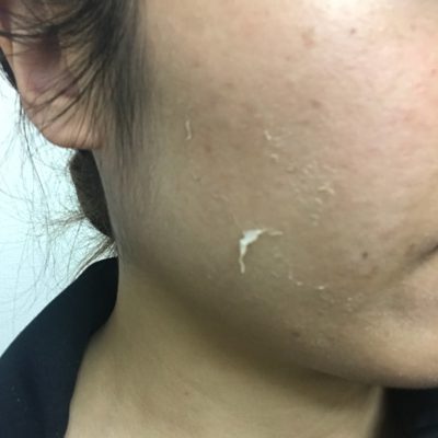 一皮剥けて来てます