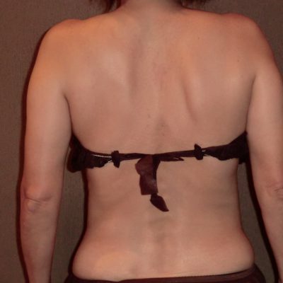 歪みを変えて腰痛撃退！