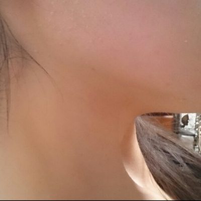 夏です！首周りを意識しましょう