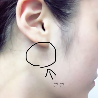 花粉症でお顔が大きくなっちゃう!?