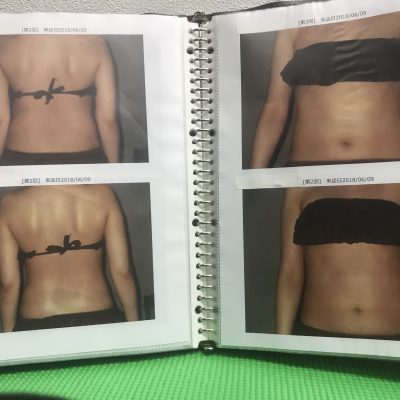 お腹周りのお肉・骨盤の歪みを気にしているあなたへ