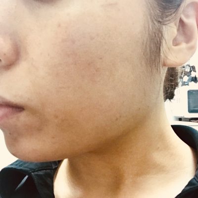 HARUちゃんの美肌育成