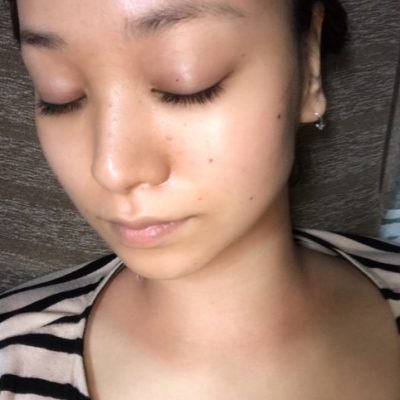 ニキビ・シミ・美白…etc