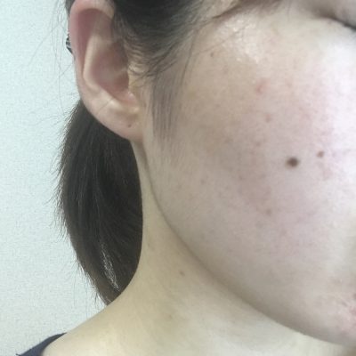 肌育プロジェクトvol.6 経過報告!