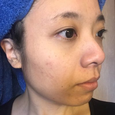 お肌のハリよ!甦れ～～!!!