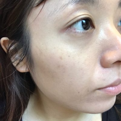 今年の古い角質は今年の内に