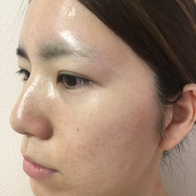 お手入れの仕方、見直しませんか？