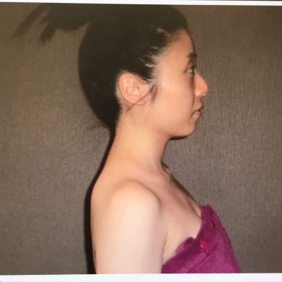 誰でも小顔になれる!老化を早めるか遅くするかはアナタ次第!!