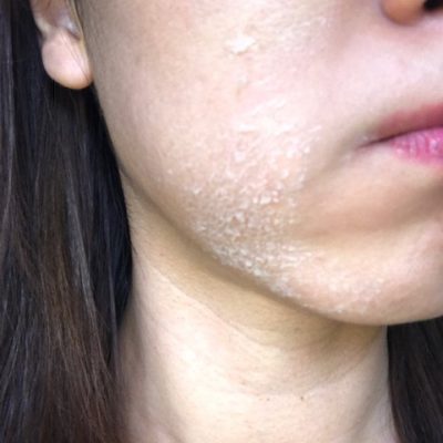 一皮むけてたまご肌☆！