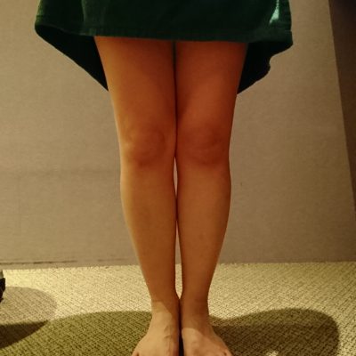 わたしの脚も・・・(>_<)