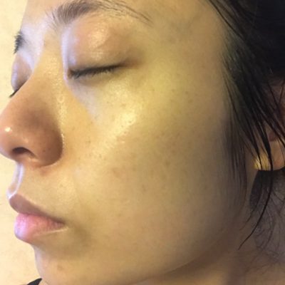 芽吹きの季節はお肌に注意!~はるかの今のお肌編~