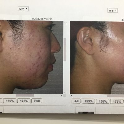 「鏡を見るのが好きになりました」PART2