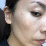 リベルハーブピーリングに夢中