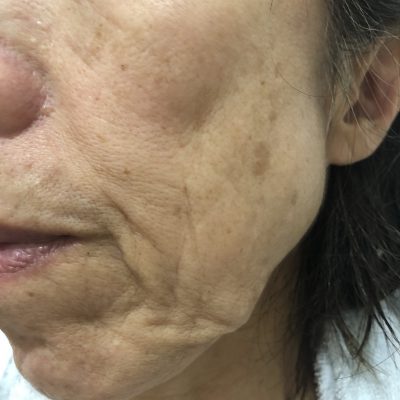 歳を重ねて若返る