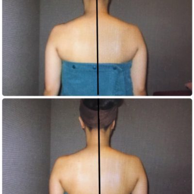 before→after（２０代）