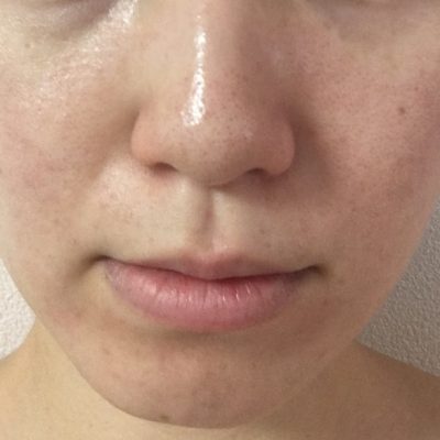 セラピストのスキンケア・その5