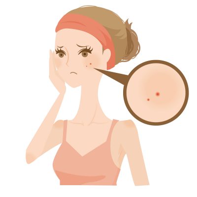 日本人は美肌菌生産が苦手?!