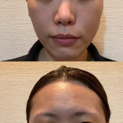 LSC化粧品を使用して感じたことをお伝えしますっ☆