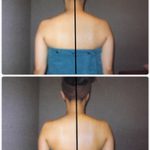 Before→After（２０代）