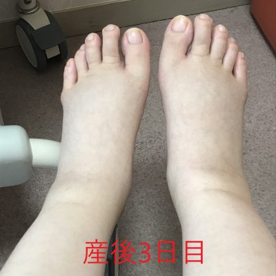 妊娠前・妊娠中・産後ケアの大切さ☆～妊娠中編～