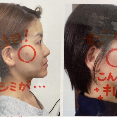 美肌育