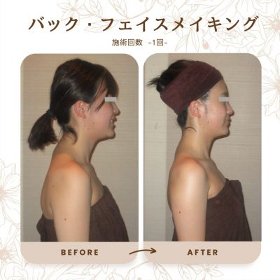 ラジェの優しい技術