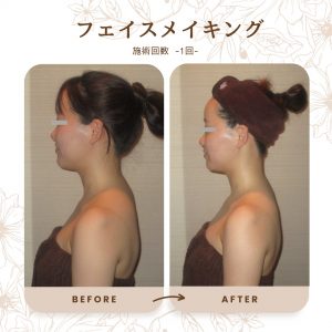 line_oa_chat_251204_094414