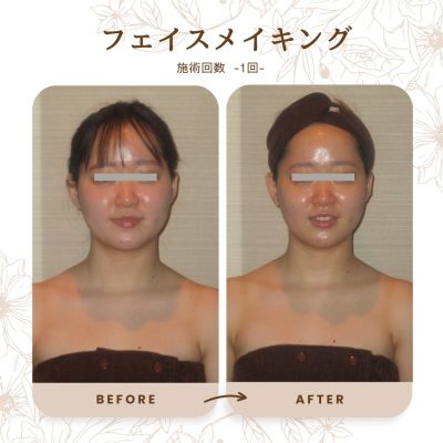 知っていました？LAGEは小顔専門サロンなのです♪