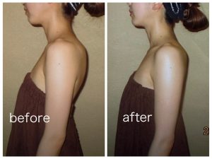 line_oa_chat_251224_110615